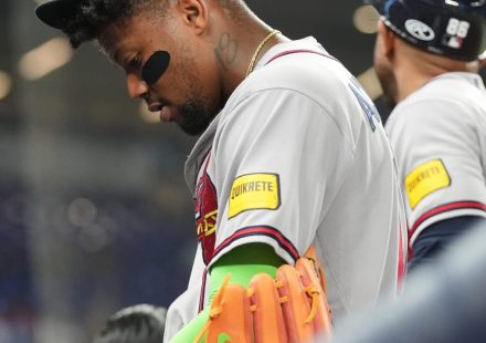 Ronald Acuña fuera de la alineación un día después de darse un foul en la espinilla