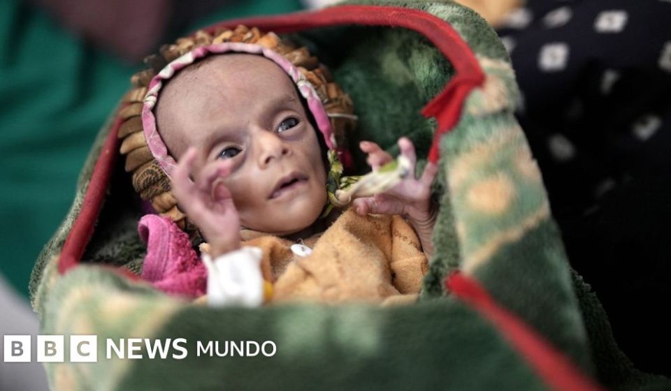"Solo piel y huesos": los gemelos recién nacidos que tratan de sobrevivir a la guerra y el hambre en Yemen