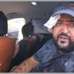 Palestinians and US journalist injured by Israeli settlers in West Bank harvest attack