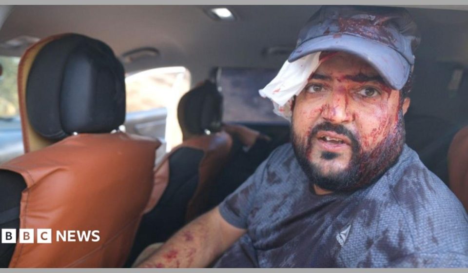 Palestinians and US journalist injured by Israeli settlers in West Bank harvest attack