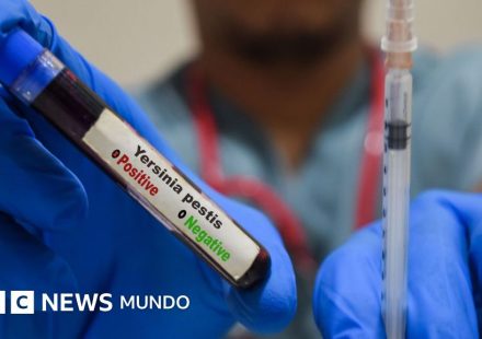 Qué es y cómo se propaga la peste neumónica que se estudia en el laboratorio de Siberia en el que falleció una trabajadora