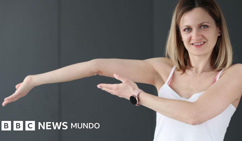 Hipermovilidad: la poco conocida "enfermedad de la flexibilidad" que causa dolor y fatiga