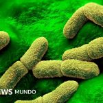 EE.UU. "sigue de cerca" el caso de una científica rusa que falleció en un centro de investigación de la peste en Siberia
