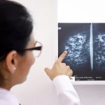 Un fármaco para suprimir la lactancia podría reducir el riesgo de cáncer de mama